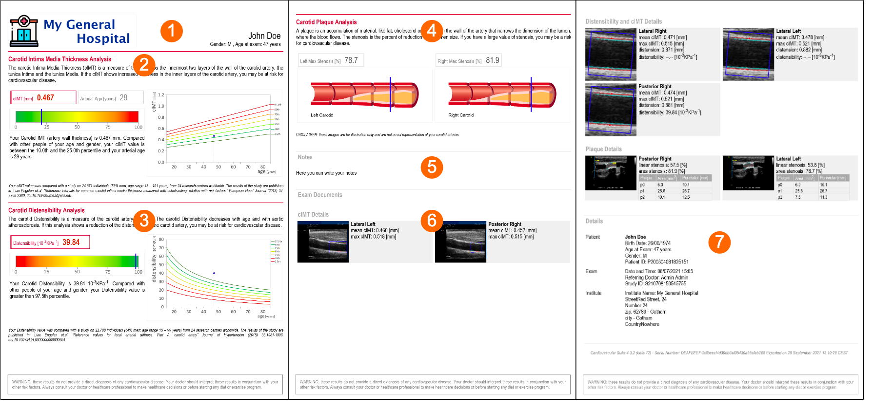 images/download/attachments/127205574/CarotidStudyReport.png