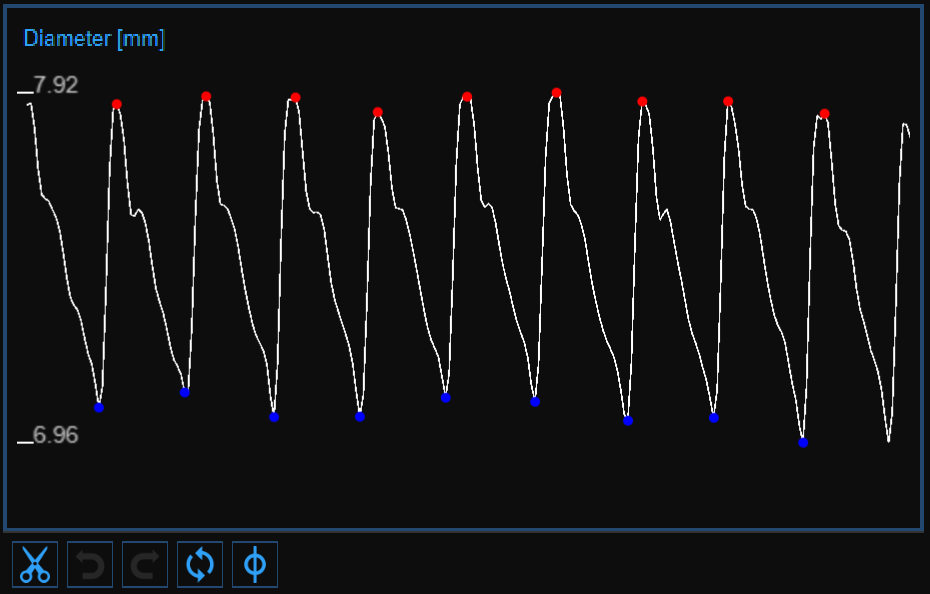images/download/attachments/34047850/CVS_Carotid_CineloopReview_DiameterChart_EN.png