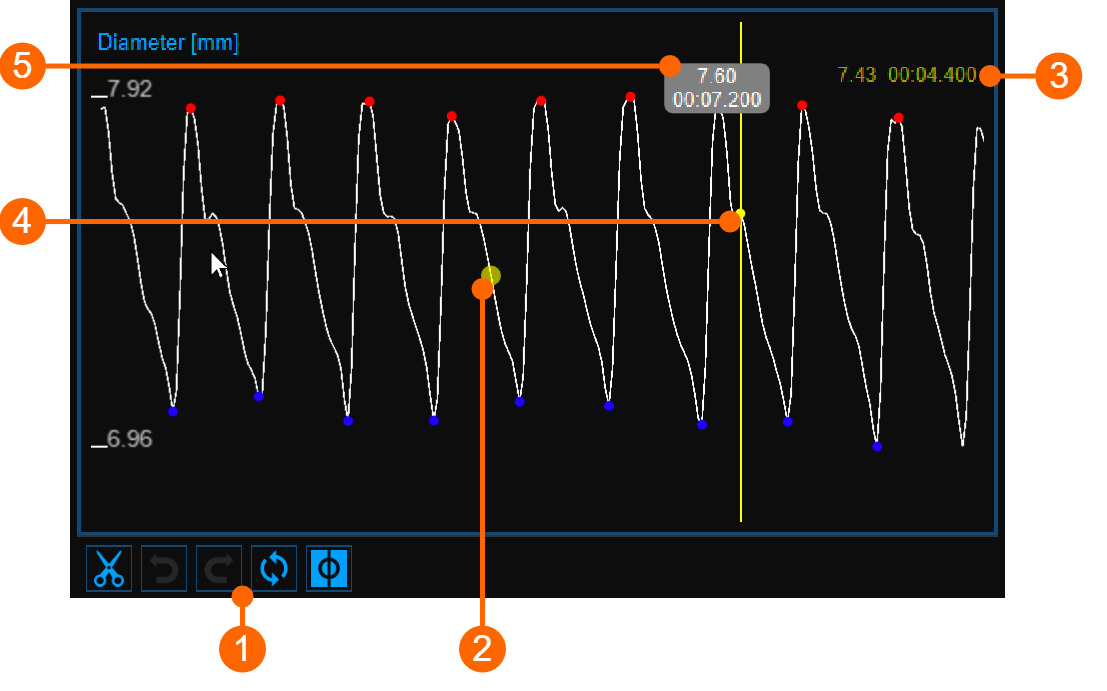 images/download/attachments/34047850/cvs_diameterChart_cineloopReview_gliffy_EN.png