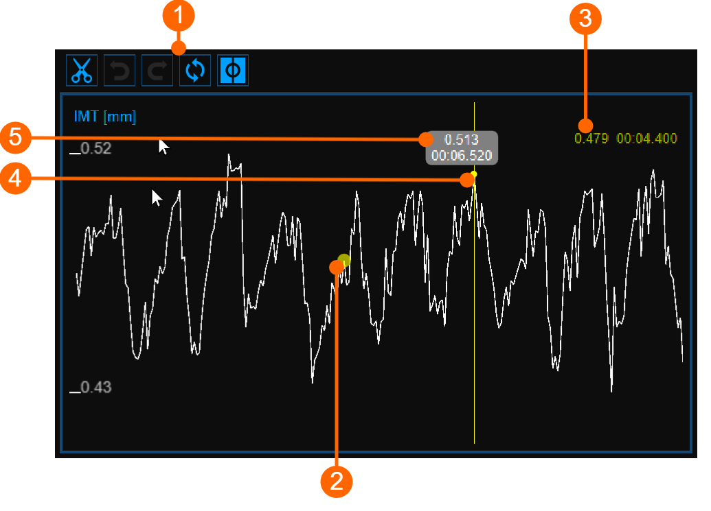 images/download/attachments/34047853/cvs_IMTchart_cineloopReview_gliffy_EN.png