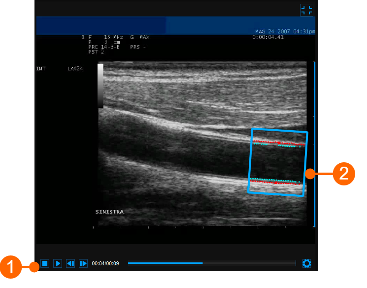 images/download/attachments/34047856/cvs_videoWindow_cineloopReview_gliffy_EN.png