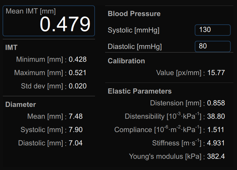 images/download/attachments/34047859/CVS_Carotid_CineloopReview_Result_EN.png