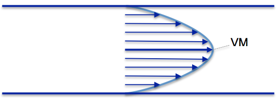 images/download/attachments/34047921/cvs_Ultrasound_DopplerFlow_profile.png