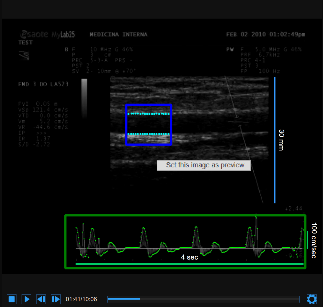 images/download/attachments/34047933/CVS_FMDReview_VideoWindow2_EN.png