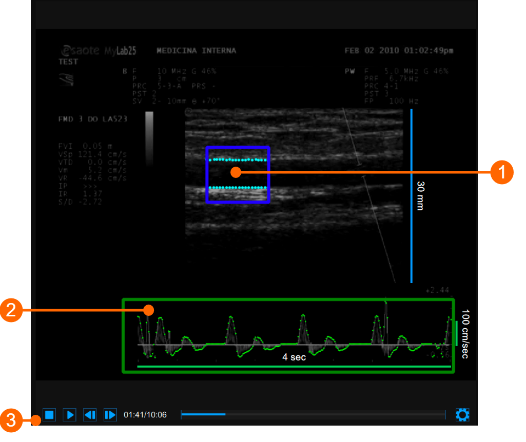 images/download/attachments/34047933/cvs_videoWindow_reviewFMD_gliffy_EN.png