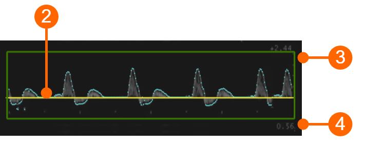images/download/attachments/89292956/cvs_setupDuplex_doppler_gliffy.png