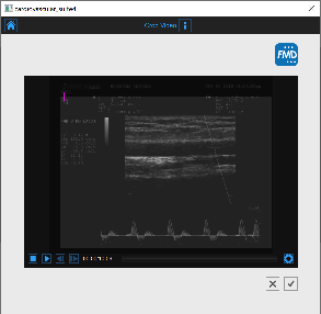 images/download/thumbnails/61636659/CVS_FMD_NewStudy_CropVideo_EN.PNG