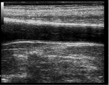 images/download/attachments/381258618/en_Ultrasound_Carotid-version-1-modificationdate-1759328517231-api-v2.png
