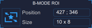 images/download/thumbnails/389054596/CVS_FMD_SetupPanel_BmodeROI_EN-version-1-modificationdate-1761924213824-api-v2.png